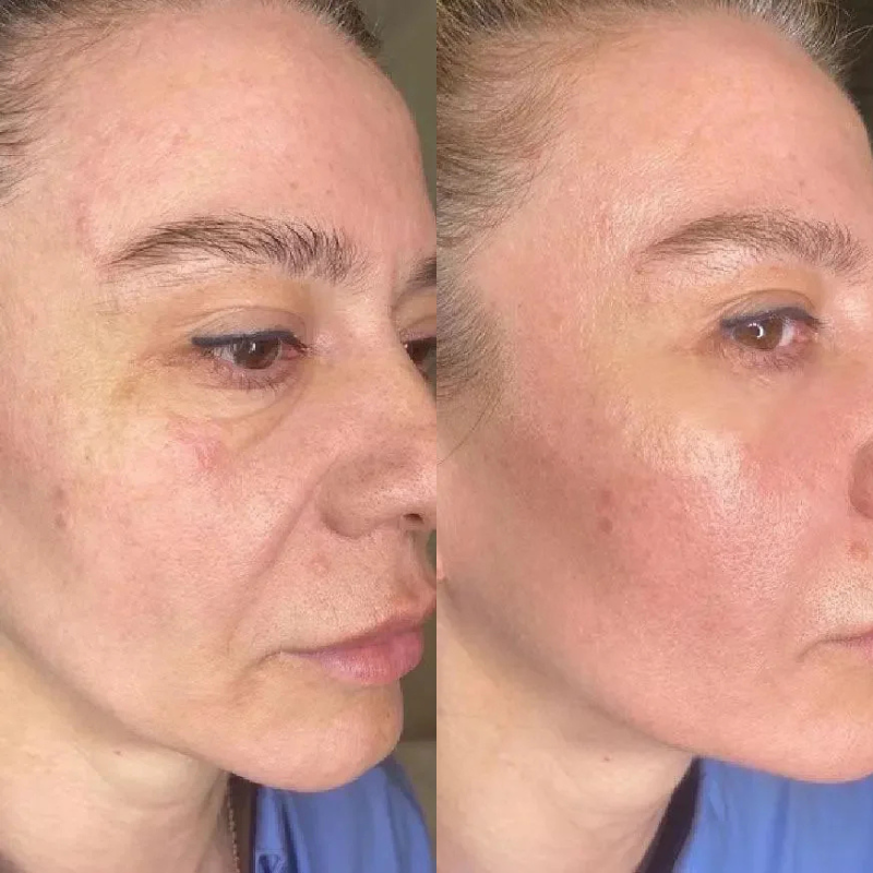 CellaGene PDRN Serum