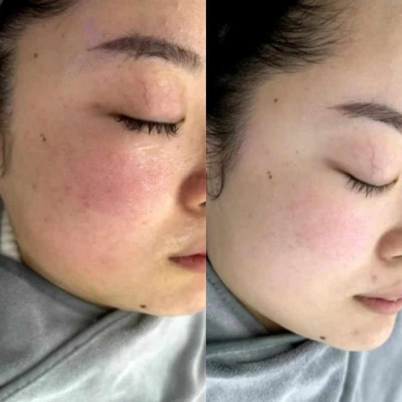 CellaGene PDRN Serum